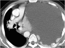 中国最原始的医学中医起源与发展
